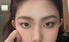 5G在视影讯5G探花